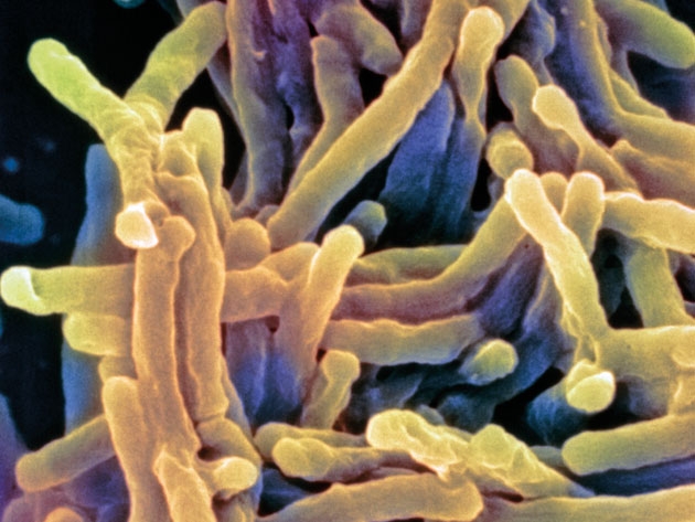 Микобактерия туберкулеза.JPG